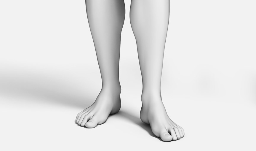 하지정맥류 시술 갑상선질환